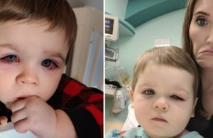 Mommy issues warning after her baby son nearly lost eyesight due to bath toy